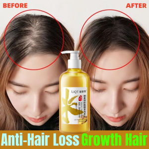 Anti off shampoo Hair growth shampoo Hair loss shampoo Ginger shampoo 500ML Ginger Hair Regrowth Dense Fast Anti Hair Loss Repair Damaged Hair Preventing Hair Fall Nourish the scalp naturally Promote hair growth Anti-dandruff Oil controlnourishing nutrien