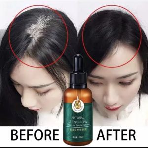Hair Growth Essence Oil Ginger Fast and Strong Hair Growth Treatment Prevent Hair Loss Nourishing Care Hair Growth