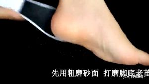 Double Sided Foot Feet Pedicure Rasp File Hard Skin Remover Removal Pedicure Smoother Foot Files Kit Heel Scraper