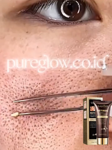 Retinol Facial Wash 100g Sabun Cuci Muka Mengencangkan Menderahkan Anti Penuaan VP088