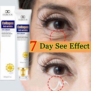 【Local stock】eye cream Dark Circles Eye Cream 20g eye cream for anti aging Remove eye bags/dark circles and lighten eye wrinkles 眼霜