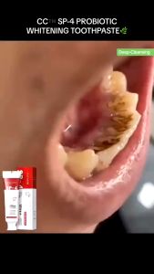 120g SP-4 Probiotic Whitening Shark Toothpaste Teeth Whitening Toothpaste Oral Care Toothpaste Gingival Protection Fresh Breath Prevents Plaque Breath Fresh Anti-Yellow Anti-Bad Breath Men Women