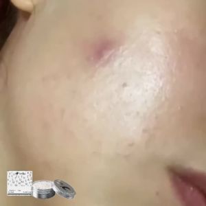 Face Scrub Redness Killer Reduce Dullness Remove Dead Skin Shrink Pore Lightweight Refreshing Moisturizing Brightening Skin Care