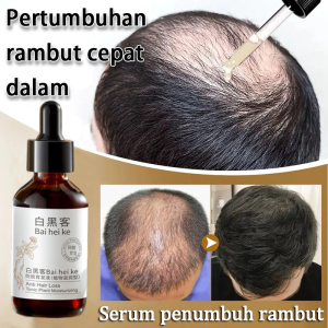 Hair Tonic Hair Growth Serum 60ml Fast Hair Growth Hair Loss Prevention Hair Anti-Hair Loss And Hair Care Hair Essence Natural Plant Extract