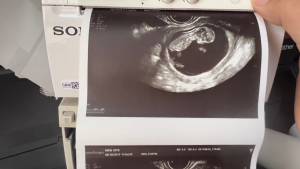 Kertas Thermal 110mm Printer Sony USG UPP 110HG/110S - Type V High Glossy 110mmx18m Original