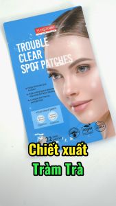 Purederm Miếng dán mụn che khuyết điểm 22 miếng