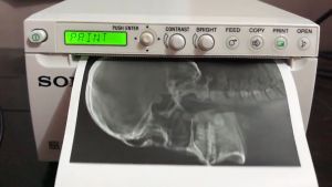 Ultrasound Thermal Paper (Video) Type 1 UPP-110S Compatible with Sony/Mitsubishi Printers 1 roll