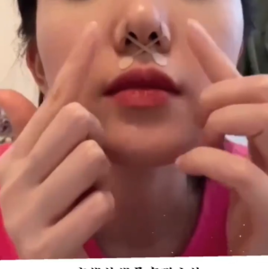 🔥MY STOCK🔥 Disposable Nose Patch/Selfadhesive Nasal Patch Finetuning The Shape Of The Nose Nose Contouring Patch Nose Repair Patch缩鼻翼小哑铃鼻翼贴 Nose Repair Patch美鼻贴 COD