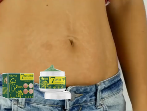 [Shouse.sg] Eelhoe Pregnancy Cream 7 Days Stretch Mark Repair Cream Powerful Obesity Body Marks Postpartum Care Scar Skin Stretch Remove Maternity Cream Stretch Marks Remove For Women Treatment Skin Care Maternity Scars Body Cream