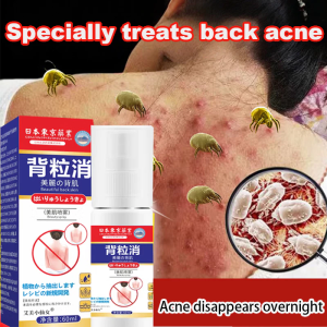 Japan Acne Body Spray Acne Remove Spray 60ml Remove Mites Remove Acne Marks Remove Back Acne
