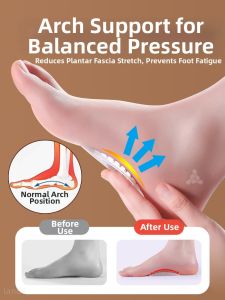 MICUI | Arch Support Insoles