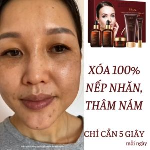 [ CHÍNH HÃNG ] Bộ 5 sản phẩm dưỡng ẩm Trắng Da EBUG Bộ Chăm Sóc Da chiết xuất trứng cá muối carviar phục hồi da Dưỡng Ẩm Trắng Dadưỡng da săn chắc chống lão hóa Se Khít Lỗ Chân Lông Bộ Dưỡng Da Chống Lão Hóa