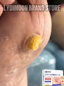 ✅[Ready Stock] Japan Wart Removal Patch Corn Plaster 12pcs Foot Corn Remover Corn Caps Painless Removal of Warts 雞眼貼