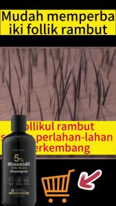 Shampoo Minoxidil 5% 300ml Sampo Penumbuh Rambut Cepat pertumbuhan rambut Pengendalian Minyak Anti rambut rontok Botak