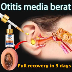 Ear Health Drops Ear Itching Tinnitus Ear Wash Ear Drops Essence Ear Stones Earwax Cleaner Liquid Softener Acute and Chronic Deafness Sore Ear Pain Care Adult Relieve tinnitus topical care cochlear antibacterial drop ear liquid 中耳炎 耳鸣 缓解 滴耳液30ml