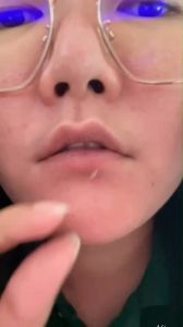 ลอกฝ้าลอกหน้าผลัดเซลล์ผิว RDL Babyface 1 2 3 ขวดใหญ่ ขนาด 60 มล. ของแท้ จาก ฟิลิปปินส์