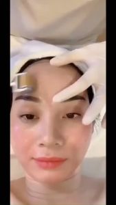 Cây Lăn Kim Tay Vàng ZGTS Đủ Size 0.25 - 0.5 - 0.75 - 1.0 - 1.5 - 2.0 Kim Lăn Tay Cho Spa/Thẩm Mỹ Viện