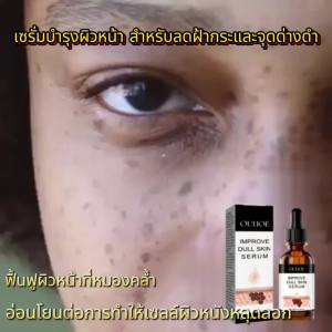 OUHOE  เอสเซ้นส์บำรุงผิวหน้าจุดด่างดำ   ทำให้เคราตินนุ่มขึ้นและซ่อมแซมใบหน้าที่หมองคล้ำจุดด่างดำและผิวขาว