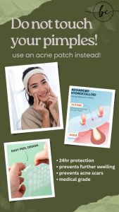 Medical Grade Hydrocolloid Acne Patch by Philoderma (100% Original)