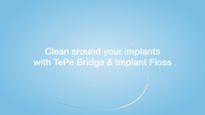 TePe Bridge & Implant Floss (30pc/pk) - Designed for cleaning implants bridges and orthodontic