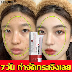 ครีมกน้า ครีมทาผิว ครีมไวท์ ครีมลดฝ้า ครีมลบฝ้า ครีมรักษาฝ้า ครีมทาฝ้า ตั้งแต่ครีมแก้ฝ้า ครีมแก้ฝ้ากระ ป้องกันริ้วรอย ดูกระจ่างผิว เทนนิ่ง หน้าขาว หน้าลดฝ้า หน้าลดฝ้า หน้าใส สำหรับเลือกคลินิกที่มีคุณภาพ"