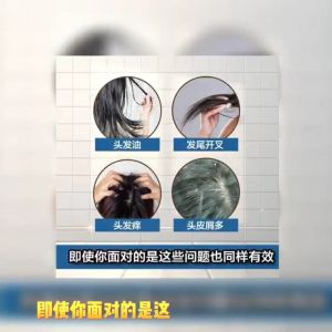 💎现货秒发 100%正品💎 ECOHAIR Aloe Vera Therapy Shampoo 芦荟洗发露 1 支 | 洁净毛囊 预防脱发 消炎抗菌 有效控油 对坑头皮屑 舒缓敏感头皮 PH 5.5 ~ 6.5