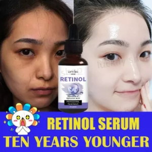 LIFTING SERUM: Mengangkat dan Memutihkan Wajah dengan Serum Retinol Anti Aging