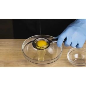 Stainless Steel Egg Yolk Separator - Easy-to-Use Kitchen Tool for Separating Egg Whites Ideal for Cooking Baking