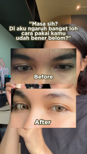 AMURA Serum Mata Panda Pencerah Lingkaran Hitam & Redakan Sembab Kantung Mata - Eye See Peptide Serum 20 ML Cooling Sensation