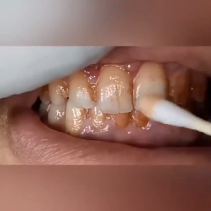 BOOM EELHOE Teeth Whitening Essence Powder Oral Hygiene Cleaning Serum Removes Plaque / Pemutih Gigi Kuning dan Karang Permanen / Pembersih Perontok Karang Gigi dan Bau Mulut / Dazzling White Pen