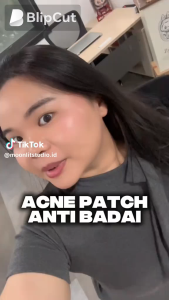 Moonlit Studio Acne Patch Plus 36s w/ Salicylic Acid + Centella - Acne Pimple Removal