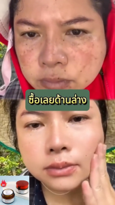 12.12sale โปรโมชั่น【แพ็คเกจส่วนลดสุดพิเศษ】377 สกินครีม ให้ความชุ่มชื้นแก่ผิว เพิ่มความสดชื่นให้กับผิวของคุณ