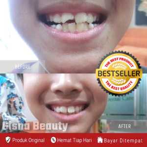 TERKUAT ORIGINAL !! Penambal gigi super kuat Gigi palsu untuk gigi ompong semua Penambal gigi ompong permanen original Gigi palsu penutup ompong lepas pasang Penumbuh gigi ompong dewasa permanen Penambal gigi ompong permanen anti kuning Temptooth Temporar
