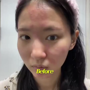 Torriden BALANCEFUL Alpine Moss Essence 50ml – Soothing & Balancing Essence with Alpine Moss Niacinamide & Ceramide for Sensitive Skin