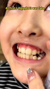 Whitening Toothpaste Anti cavity Ubat Gigi Pemutih 120g Dental Problem Solution Fresh Breath Teeth Stains Removal Probiotics Oral Care 美白牙膏 清新口气