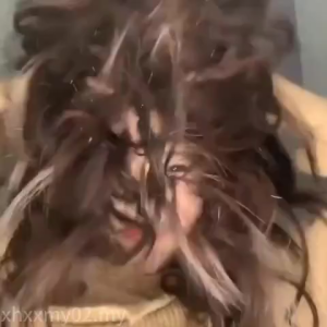 Dandruff Shampoo selenium sulfide shampoo 300ml Treat Psoriasis  Anti-DandruffOil ControlSeborrheic dermatitis.