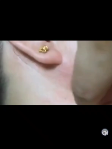 [Shipping in Thai] เลเซอร์พลาสมา ปากกา กำจัดไฝ กำจัดไฝ กำจัดไฝ