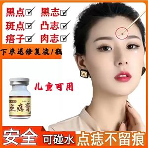 Mole spot ointment mole removal potion spirit black remove meat artifact facial beauty salon
