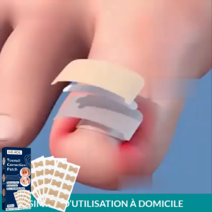 Eelhoe Toenail Correction Patch Nail Ingrown Correction Stickers Waterproof Nail Repair Patches （10 Patches X 5 Sheets Per Box） ﻿ ﻿ ﻿