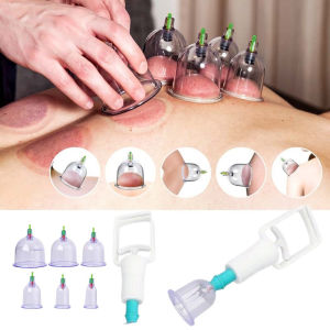 6/12pcs Aspirating Cupping Device Household Vacuum Cupping Set for Body Massage Relaxation Manual Suction Cup Kit Health Gifts