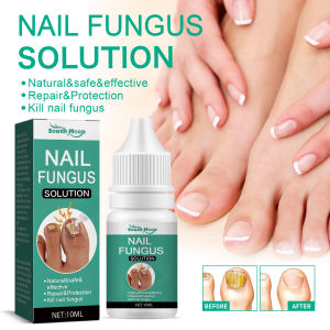 Obat Jamur Kuku Paling Ampuh Nail Repair Essence Serum Ajaib Viral Di Mengobati Kuku Berjamur Dan Rusak