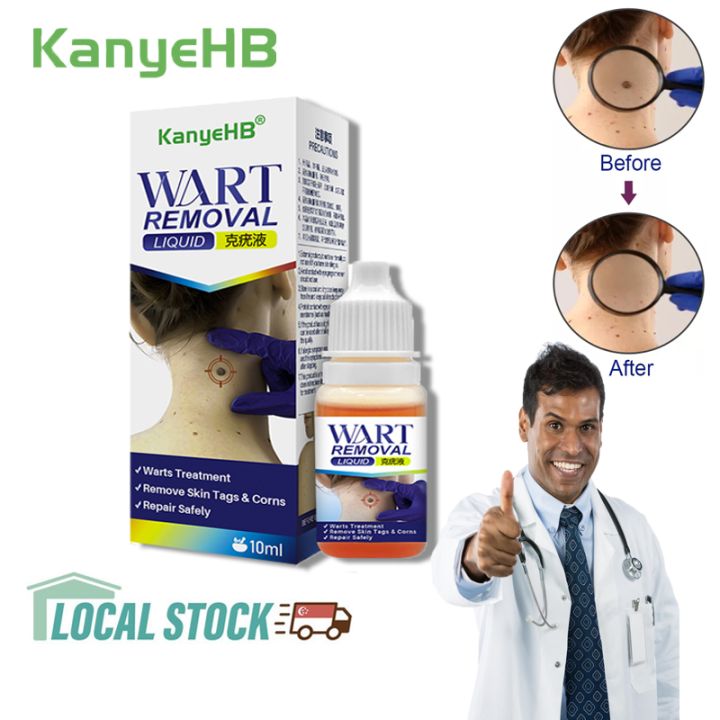 Kanyehb 100 Original Warts Remover Liquid Treatment Genital Warts Sharp Warts Filamentous 10ml 8122