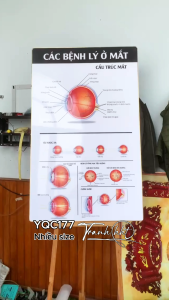 Tranh Y khoa Các Bệnh Lý Ở Mắt tranh Cấu Trúc Và Tật Khúc Xạ tráng gương treo tường Tranh Nhãn khoa treo tường YQC177