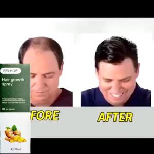 Beli 2 Gratis 1: Serum Pemanjang Rambut & Anti Tonik Rambut Rontok
