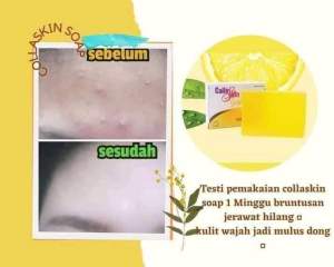 Csoap NASA ori // sabun collagen muka//anti kusam hempas flek hitam