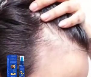 LIFUSHA EELHOE Spray Penumbuh Rambut Cepat - Obat Kebotakan Pria BPOM Anti Rontok Parah & Regenerasi Folikel