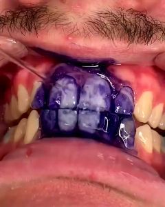 V34 Colour Corrector Pasta Gigi Pemutih Gigi Kuning Pembersih Karang Gigi Membandel Teeth Whitening Toothpaste Odol Penghilang Karang Gigi