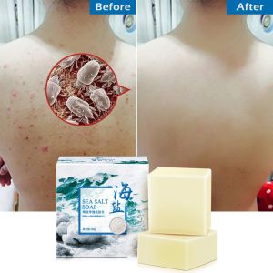 Sea Salt Soap Goat Milk Soap Bar Mite Removal Soap Oil-Control Cleansing Soap Acne Treatment Whitening Blackhead Removal