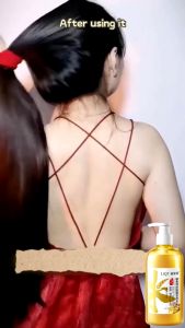 Shampoo Penumbuh Rambut Cepat & Perawatan Rambut Rontok