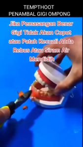 Temptooth Penambal Gigi Sementara | Tambal Gigi Copot Patah Lubang | Bahan Aman & Praktis Tanpa ke Dokter